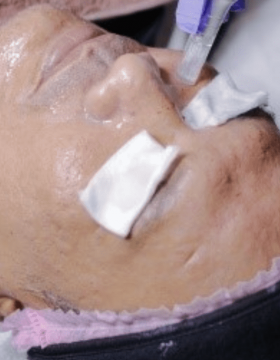 HOLLYWOOD DEEP NUTRISION FOR SCAR