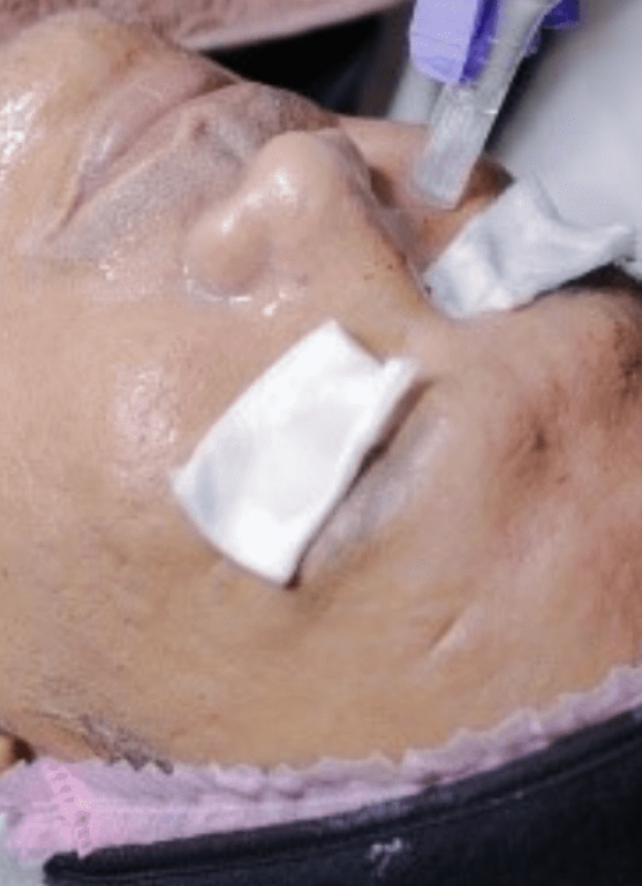 HOLLYWOOD DEEP NUTRISION FOR SCAR