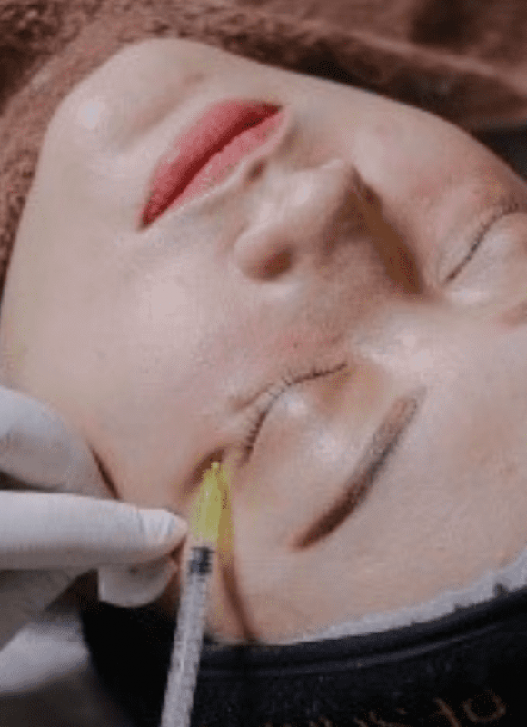 Inject Eye Bag